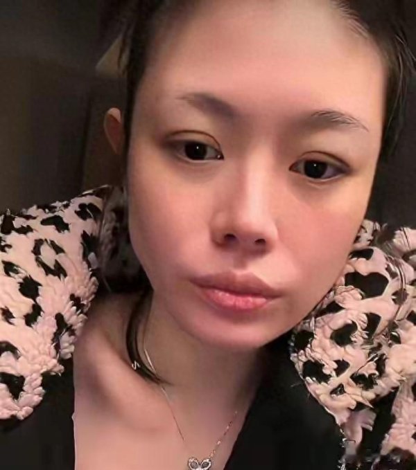 汪峰前妻自曝被男友暴打, 已果断分手: 家暴这东西, 一次都不能忍